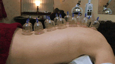 Cupping on the back to relax